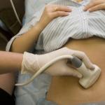 Ultrasonda hamileliği göremezler mi Ultrasonda embriyo ne zaman görülebilir